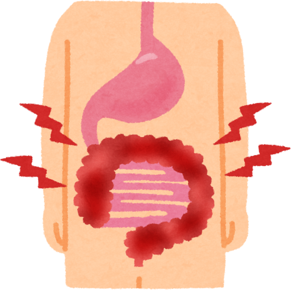 Watercolor Illustration of Inflamed Intestine